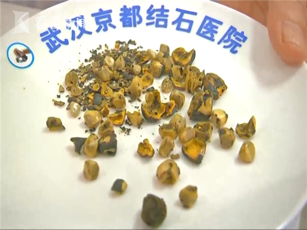 “三亿体育官网”空调打响三月价格大战智能旋风推动行业洗牌(图3) 三亿体育